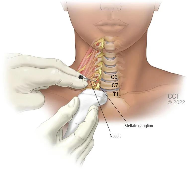  whistle crayfish crawfish crawdad crawdaddy syringe centipede-0