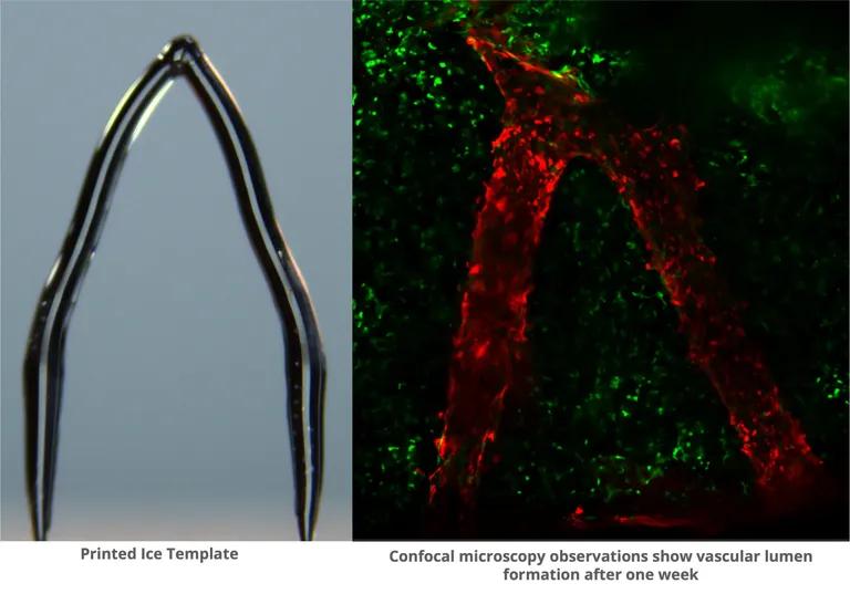  nematode nematode worm roundworm hook claw oscilloscope scope cathode-ray oscilloscope CRO bolo tie bolo bola tie bola-0