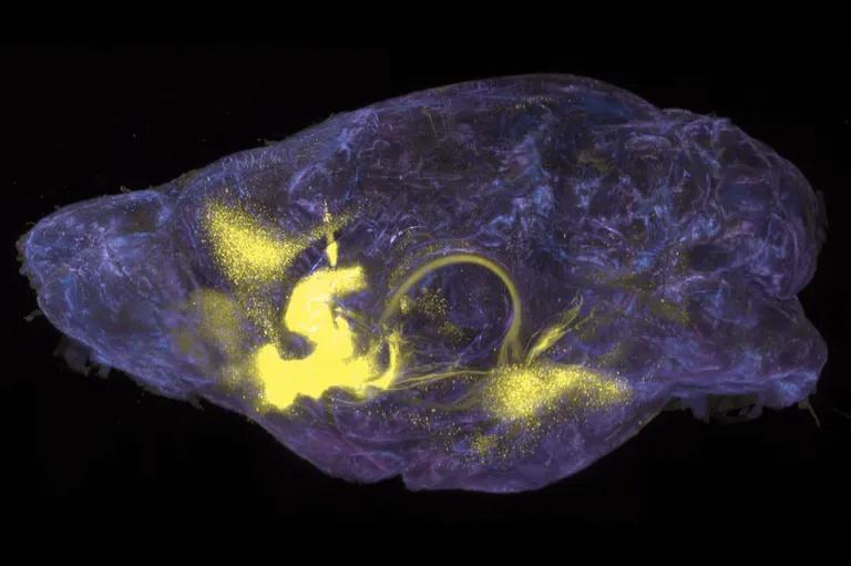  shower cap jellyfish plastic bag nematode nematode worm roundworm-0