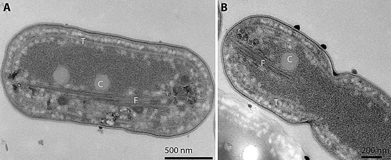  nematode nematode worm roundworm flatworm platyhelminth chiton coat-of-mail shell sea cradle polyplacophore jellyfish-0