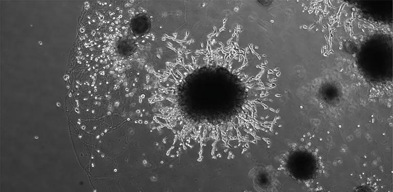  nematode nematode worm roundworm daisy Petri dish bubble-0