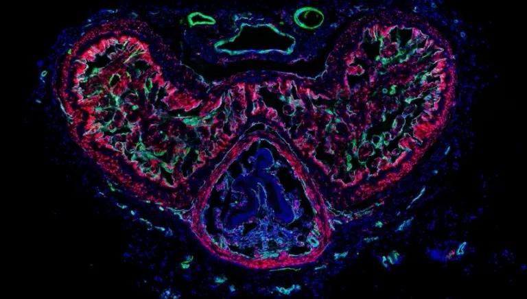  nematode nematode worm roundworm jellyfish chiton coat-of-mail shell sea cradle polyplacophore bib-0