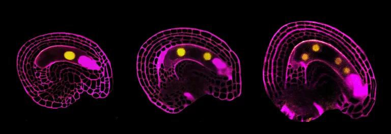  nematode nematode worm roundworm jellyfish nipple maze labyrinth-0